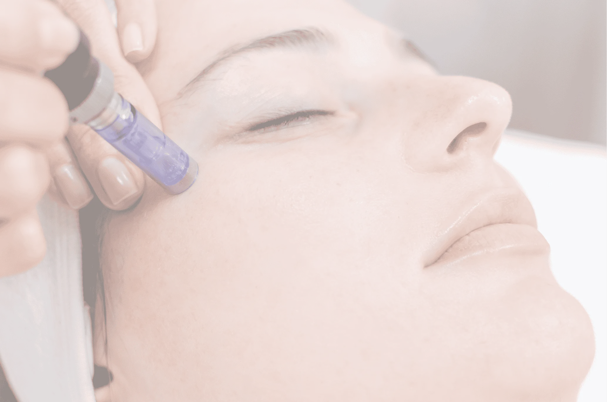 Premium Microneedling
