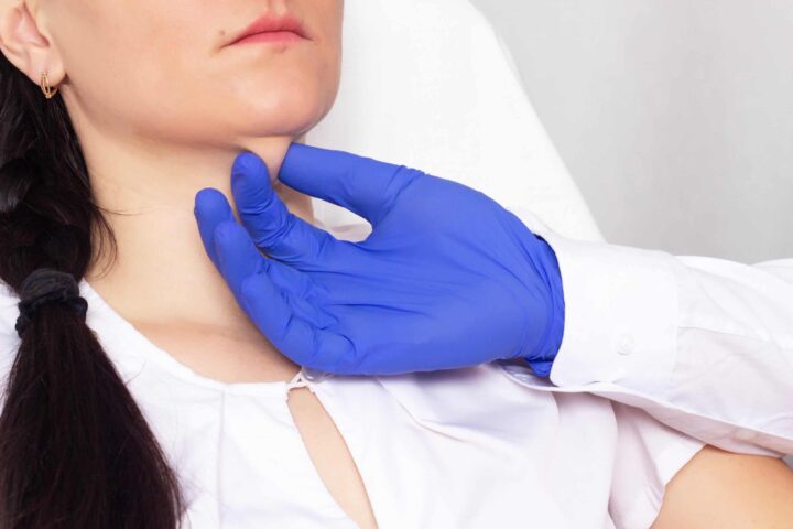 Kybella
