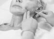 PDO Thread Lift: Lift your Jaw, Neckline, Brows, Mid Face & More