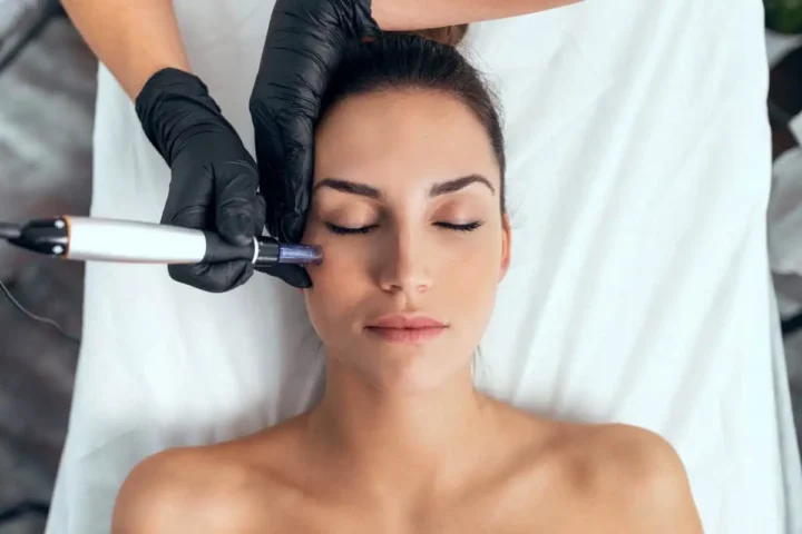 Microinfusion Microneedling by Studio Medical Aesthetics in Newport KY