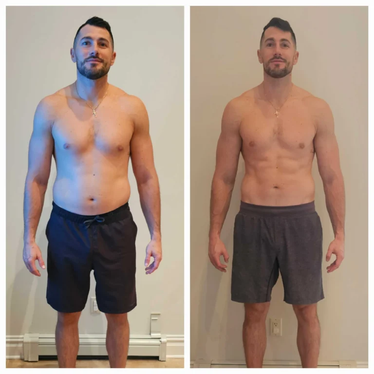 BEFOREAFTER1 1 scaled
