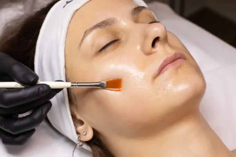 Women receiving Chemical Peel in Newport, KY