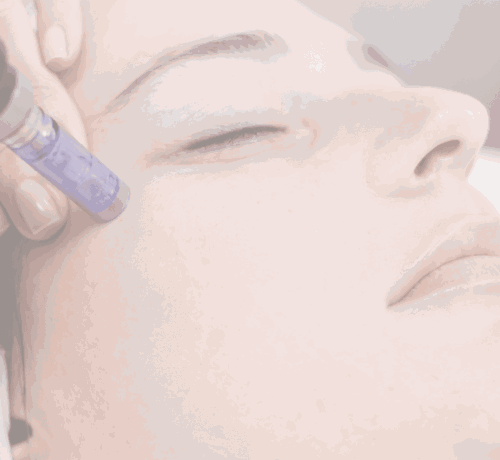Premium Microneedling