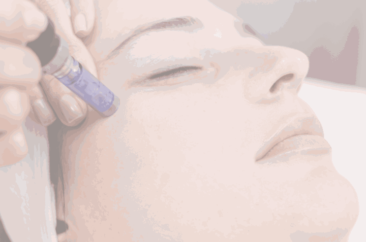 Premium Microneedling