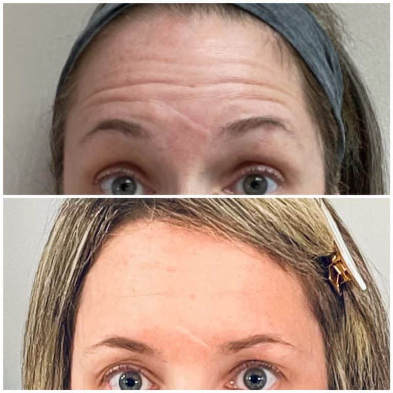 Gallery | Med Spa Newport, Lexington, KY - Studio Medical Aesthetics