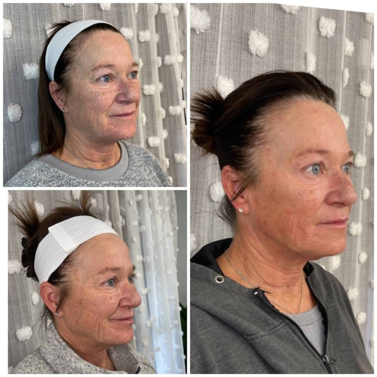 Gallery | Med Spa Newport, Lexington, KY - Studio Medical Aesthetics