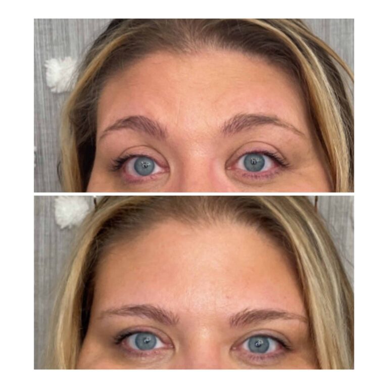 Gallery | Med Spa Newport, Lexington, KY - Studio Medical Aesthetics