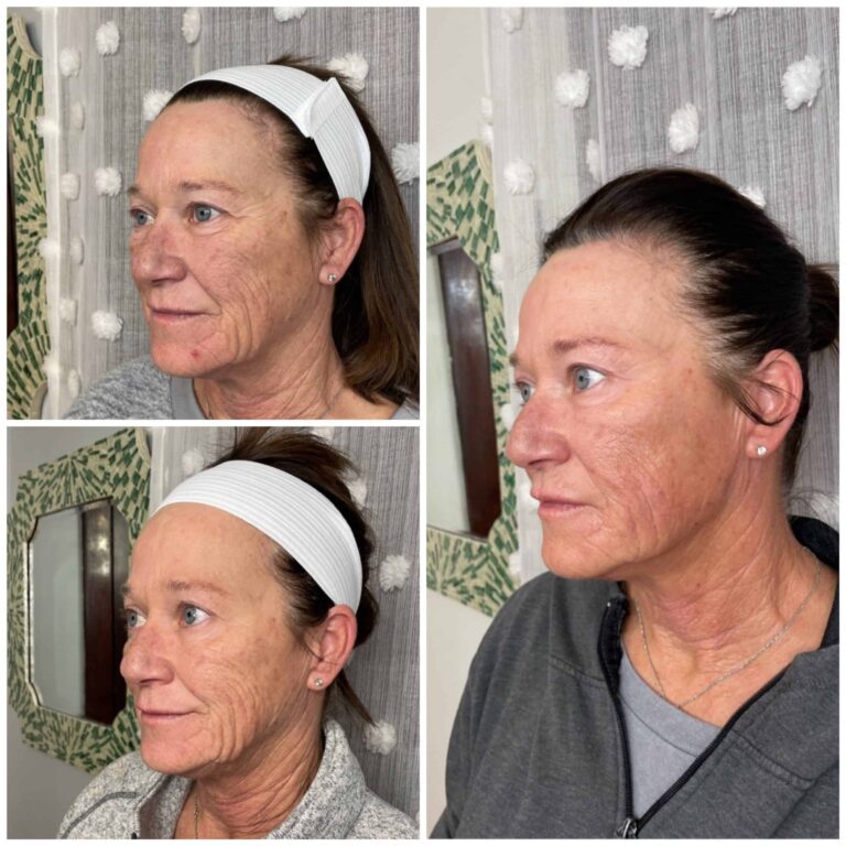 Gallery | Med Spa Newport, Lexington, KY - Studio Medical Aesthetics