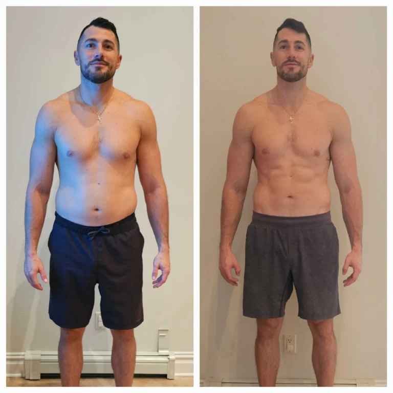 NATURAL WEIGHT LOSS IN KENTUCKY WITH THINNR 5 Weight loss before and after image in Newport and Georgetown, KY by Studio Medical Aesthetics