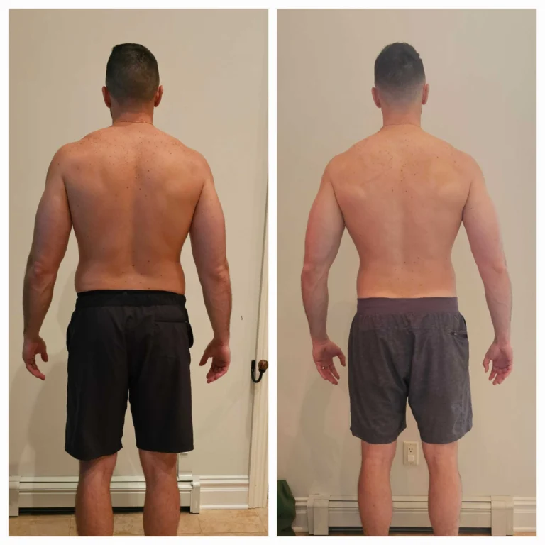 NATURAL WEIGHT LOSS IN KENTUCKY WITH THINNR 4 Weight loss before and after image in Newport and Georgetown, KY by Studio Medical Aesthetics