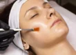 Women receiving Chemical Peel in Newport, KY