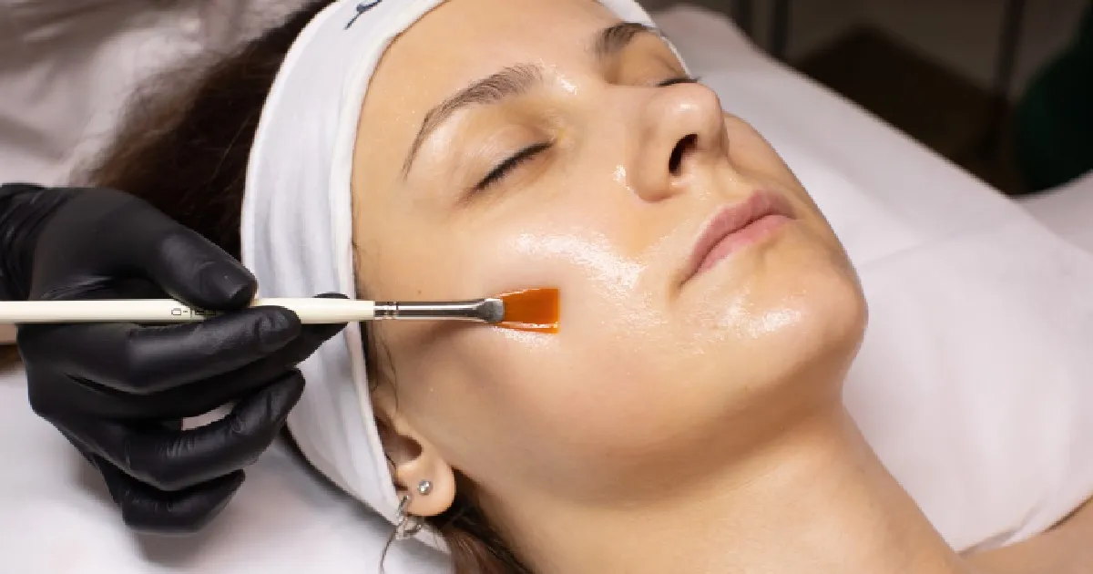 Women receiving Chemical Peel in Newport, KY